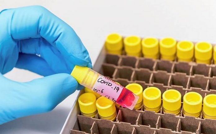 BL05PG3CORONAVIRUS