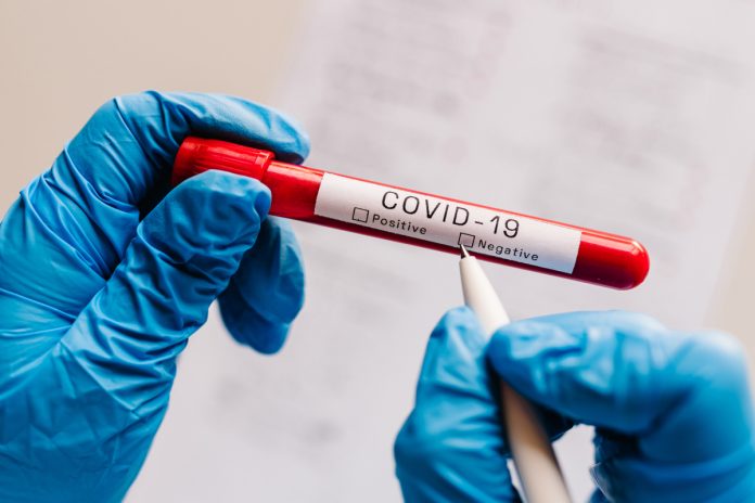 covid test rate