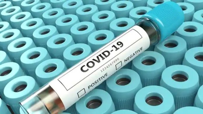 covid-test-jpg_710x400xt