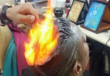 man-suffers-burns-after-fire-haircut-goes-wrong-at-salon-in-gujarat